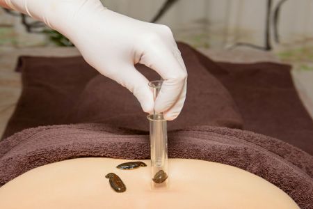 Минеральные ванны