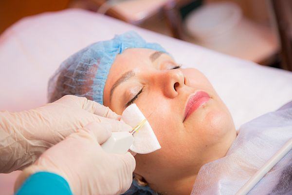 Карбокситерапия